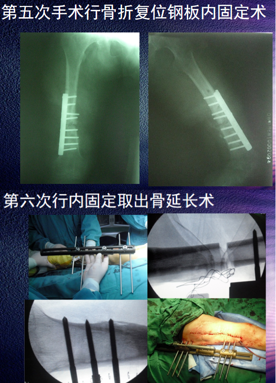 3d765db2b376f4ffcdef260a4fc63258.png image.png